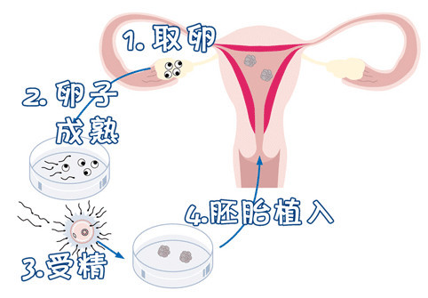 李晴阳院长